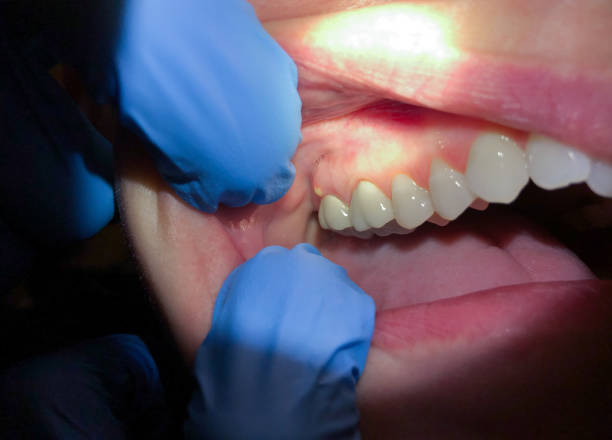 Best Emergency TMJ Treatment in St Charles, IL