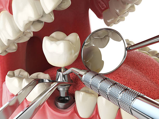 Best Pediatric Emergency Dentist in St Charles, IL